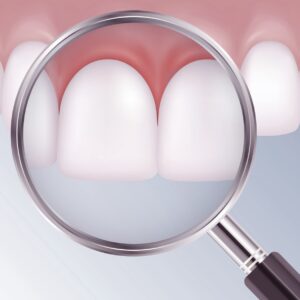 Periodontal Services